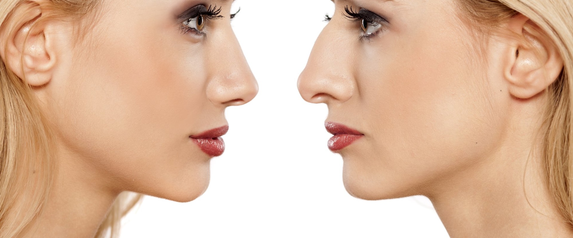 The Truth About the Longevity of a Nose Job