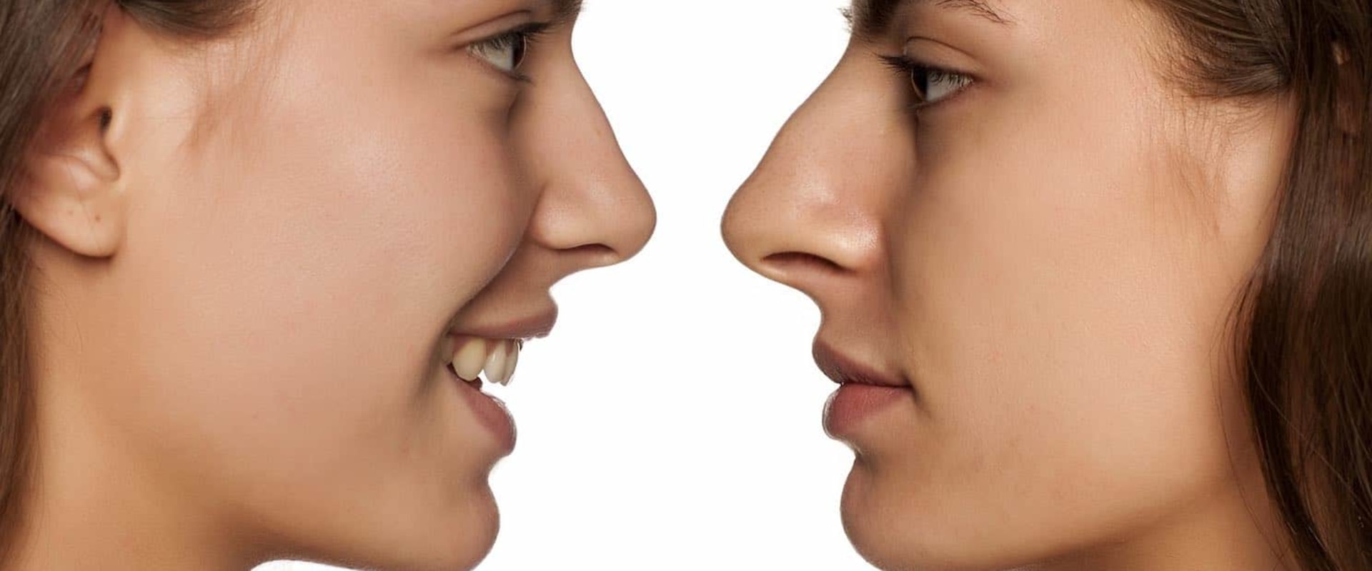 What happens to a nose job after 10 years?