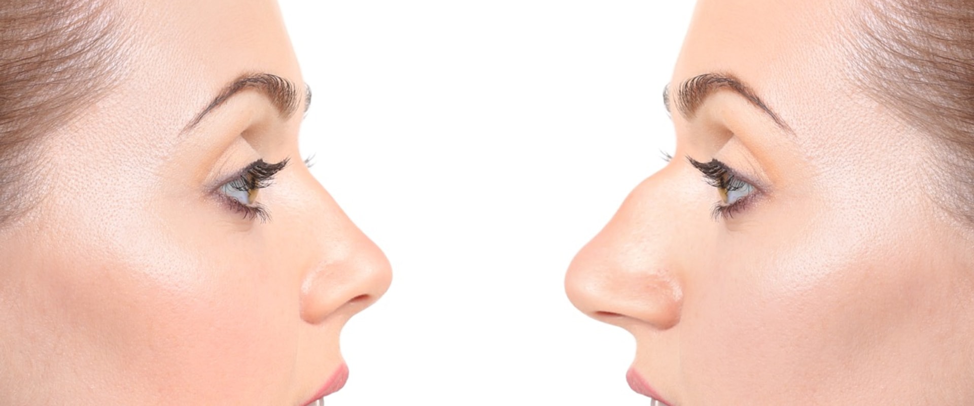 Where is the most affordable place to get a rhinoplasty?