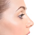 The True Cost of Rhinoplasty: What You Need to Know