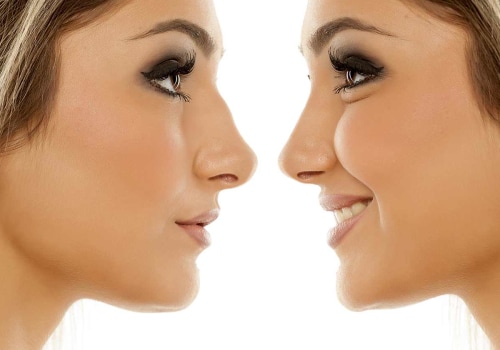The Ultimate Guide to Getting a Nose Job in South Korea: An Expert's Perspective